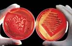 دانلود-جزوه-باکتری-شناسی-اختصاصی-و-بیماری-های-باکتریایی-دام-پزشکی